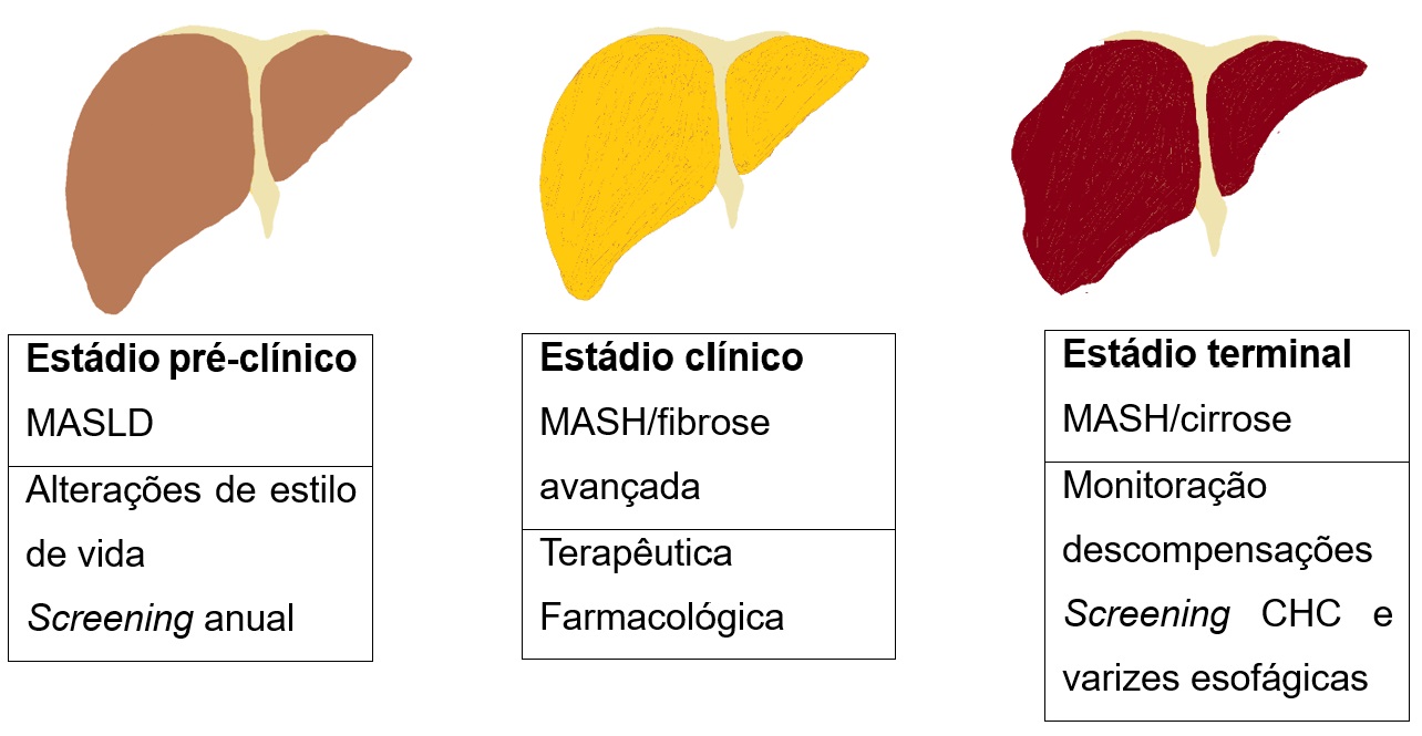 Figura 1: Diferentes estádios da MASLD e respetivas atuações. Adaptado com autorização de Pandyarajan et al.21 CHC – carcinoma hepatocelular.